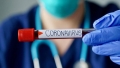 Коронавирусът: 2462 нови случая у нас, 91 починали