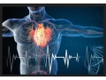 Инсулти и инфаркти – най-честата причина за смъртност у нас