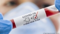 Под 600 нови случая на коронавирус за последното денонощие у нас