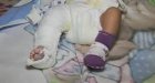 Родителите на бебето със счупено в МБАЛ-Благоевград краче: Никой не ни каза, че е откарано в  Пирoгов , оказа се, че камерите в неонатологията не работят