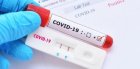 Без нови случаи на коронавирус в Благоевград за последното денонощие