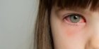 Пазете очите си! Учени говорят за странен симптом на новия вариант на COVID-19