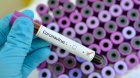 6 нови случаи на коронавирус