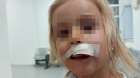 4-годишно дете пострада, след като бе нападнато от куче в Кюстендил