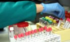 217 са новите потвърдени случаи на коронавирус у нас за последното денонощие