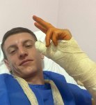 ЗАКЪСА ГО: Иван Рълев счупи ръка докато кара ски в Банско