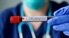 Седем са регистрираните новозаразени с коронавирус у нас през изминалото денонощие