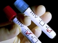 Нови случаи на СПИН и сифилис са регистрирани в област Кюстендил