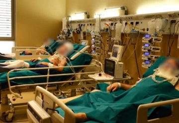 МЗ: Имате ли тези 4 симптома, категорично сте заразени с Делта варианта на К-19