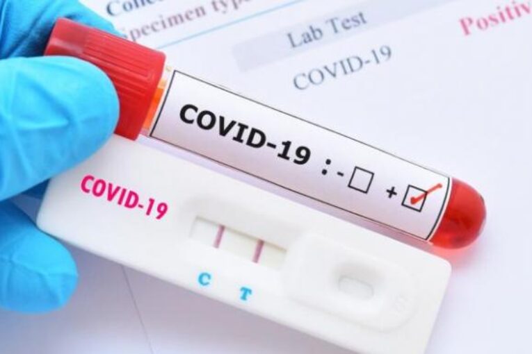 64 нови случая на коронавирус в област Благоевград
