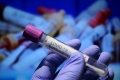 74 нови случаи на коронавирус у нас, няма починали