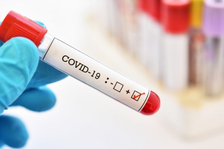 3 нови случаи на COVID-19 в област Благоевград