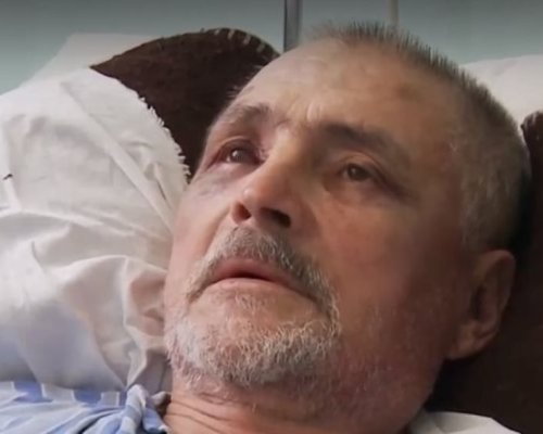 Мъжът, пребит от адвокат в Петрич: Извива ми пръстите и ги чупеше, трошеше ми главата