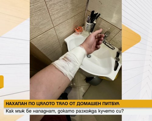 СЛЕД РЕДИЦА СИГНАЛИ: Мъж е нахапан от съседски питбул