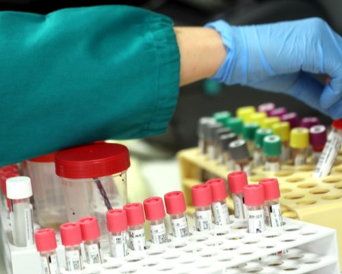 136 са новите потвърдени случаи на коронавирус у нас за последното денонощие