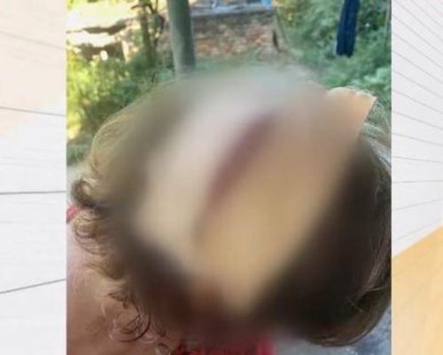 Мъж преби жена с бухалка, дразнело го кучето и