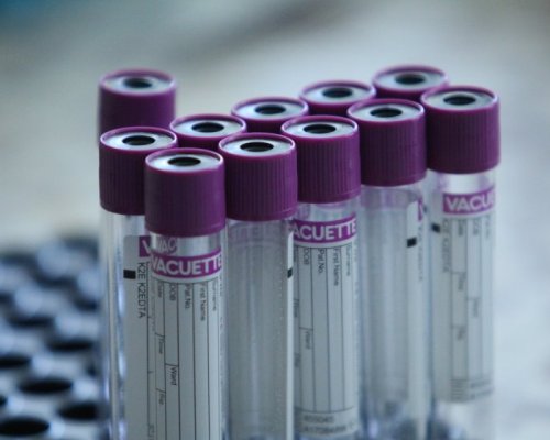143 са новите случаи на коронавирус у нас