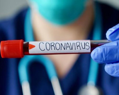442 са новите потвърдени случаи на коронавирус у нас за последното денонощие