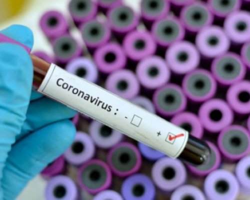 21 са новите случаи на COVID в Благоевград