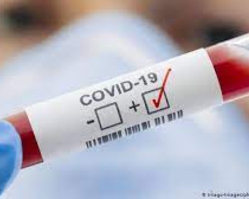 357 нови случая на COVID - 19 у нас
