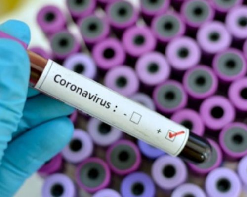 298 са новите случаи на COVID-19 у нас