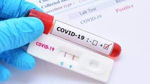 196 са новите случаи на COVID-19 у нас
