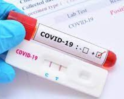 196 са новите случаи на COVID-19 у нас