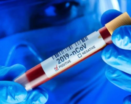 Пет новорегистрирани с COVID-19 в Благоевград