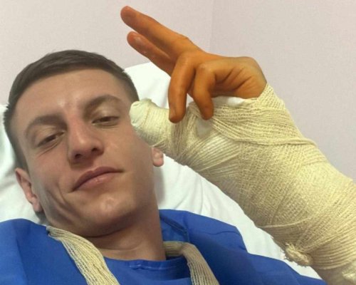 ЗАКЪСА ГО: Иван Рълев счупи ръка докато кара ски в Банско