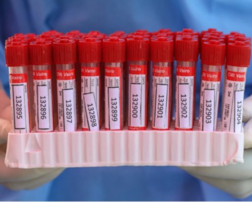 4 са новите случаи на коронавирус у нас