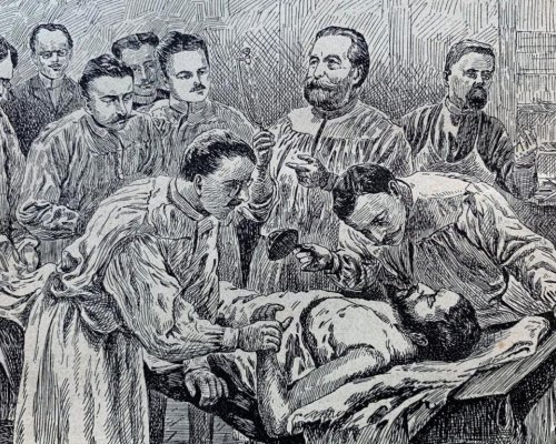 Странната и шокираща история на трансплантациите на животински органи на хора