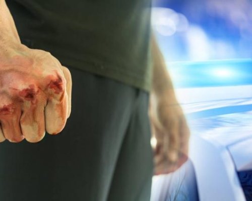 Пиян треньор по бокс преби 33-годишна жена, откараха я в болница