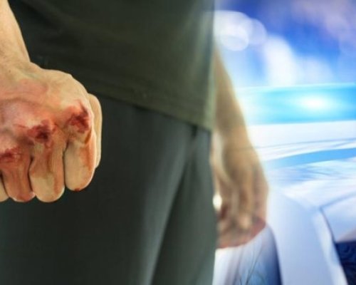 Двама се биха в Благоевград, един е със счупена челюст