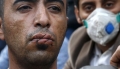 Мигранти си зашиха устните в района на гръцко-македонската граница