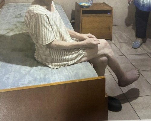 Правосъдният министър: Жена е с ампутирани ходило и пръсти