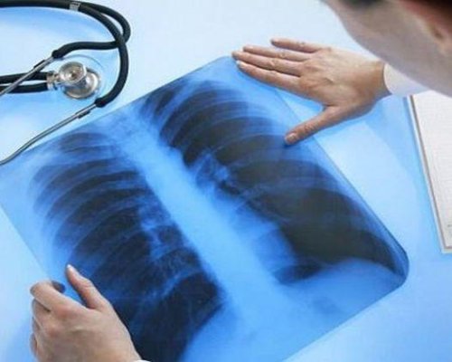 Безплатни профилактични прегледи за белодробни заболявания в Сандански