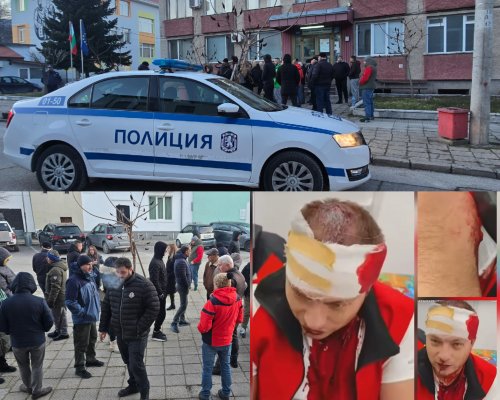 Има задържани за побоя над Станислав Жулев в Гоце Делчев, прокуратурата повдига обвинение